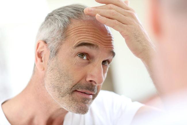 如何预防白头发出现？3个方法帮助您！